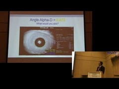 AAO 18 (3) - Dr. Shultz at the iTrace Users Meeting