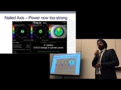 2019 AAO (1) Paul Singh at the iTrace Users Meeting