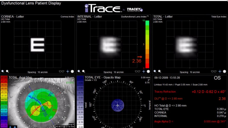 The iTrace 6 Vision Center