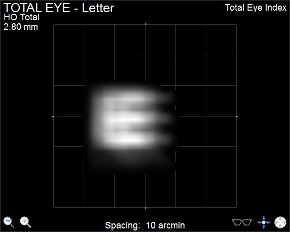 iTrace Cornea Testing - Letter E Display