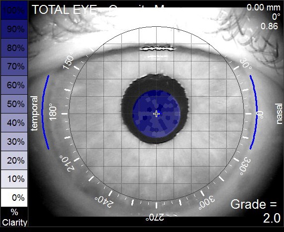 Total Eye Opacity Display