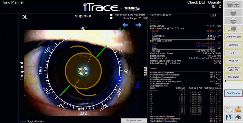 itrace excel