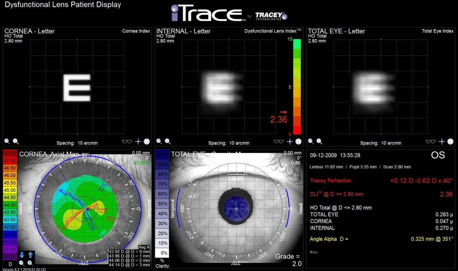dli-display Advanced Vision Center