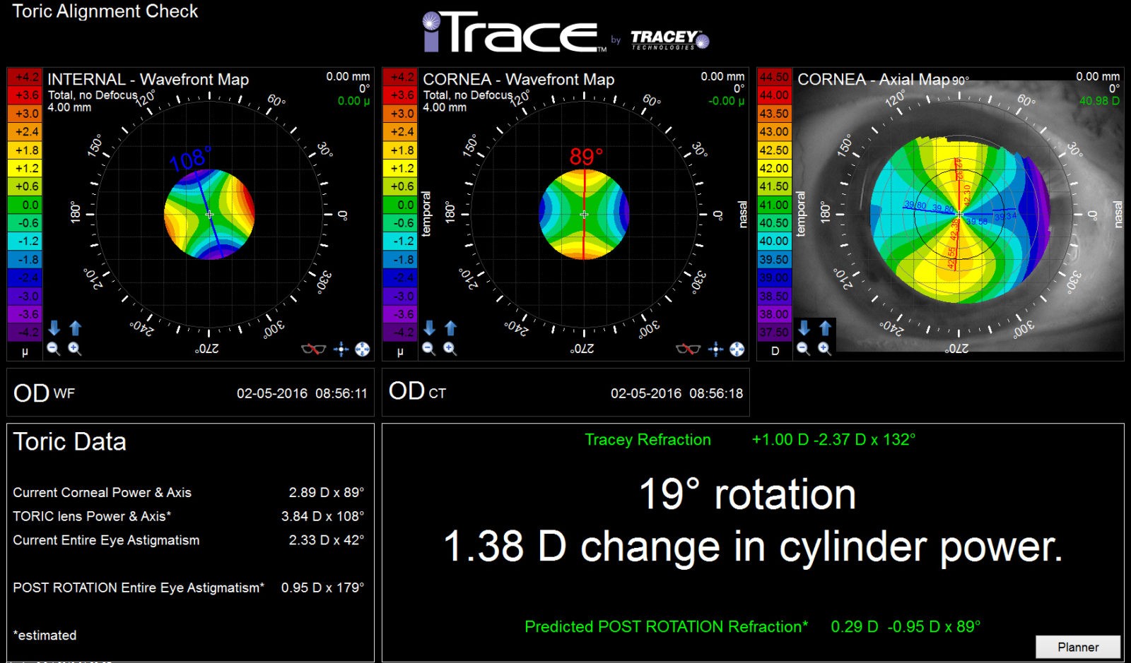itrace eye scan toric alignment check