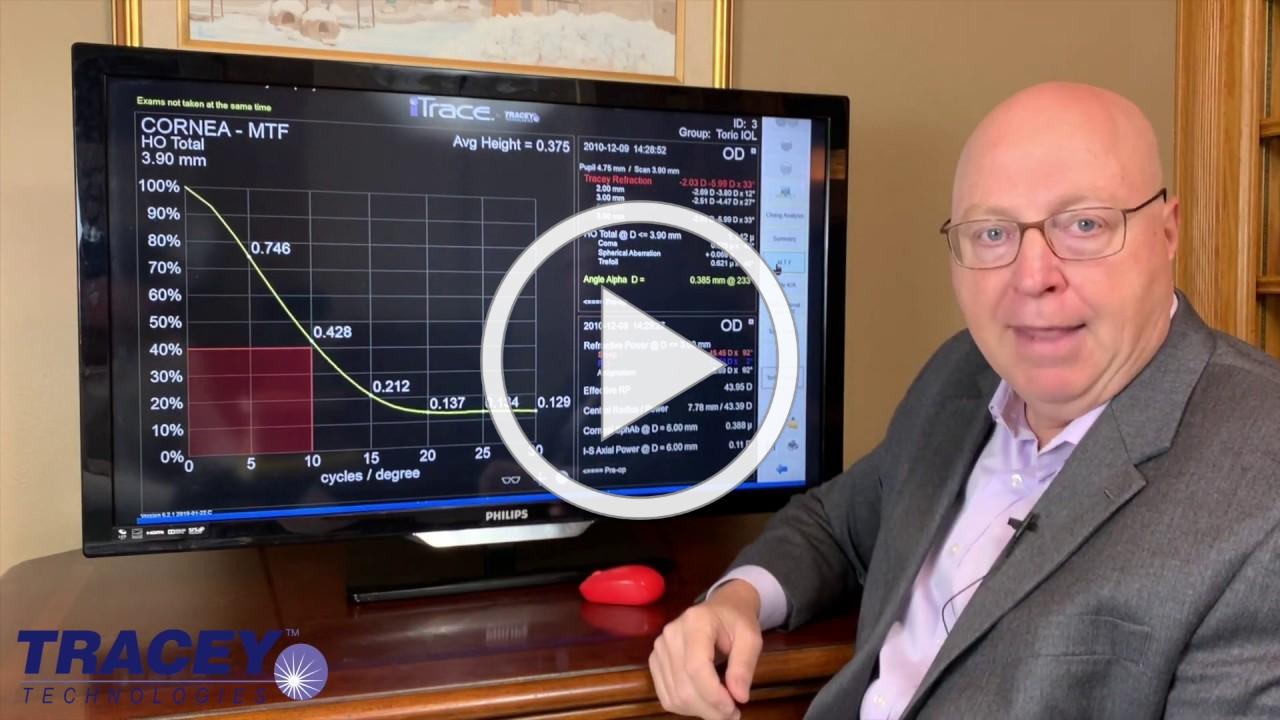 Video discussion of Corneal MTF graph in the iTrace