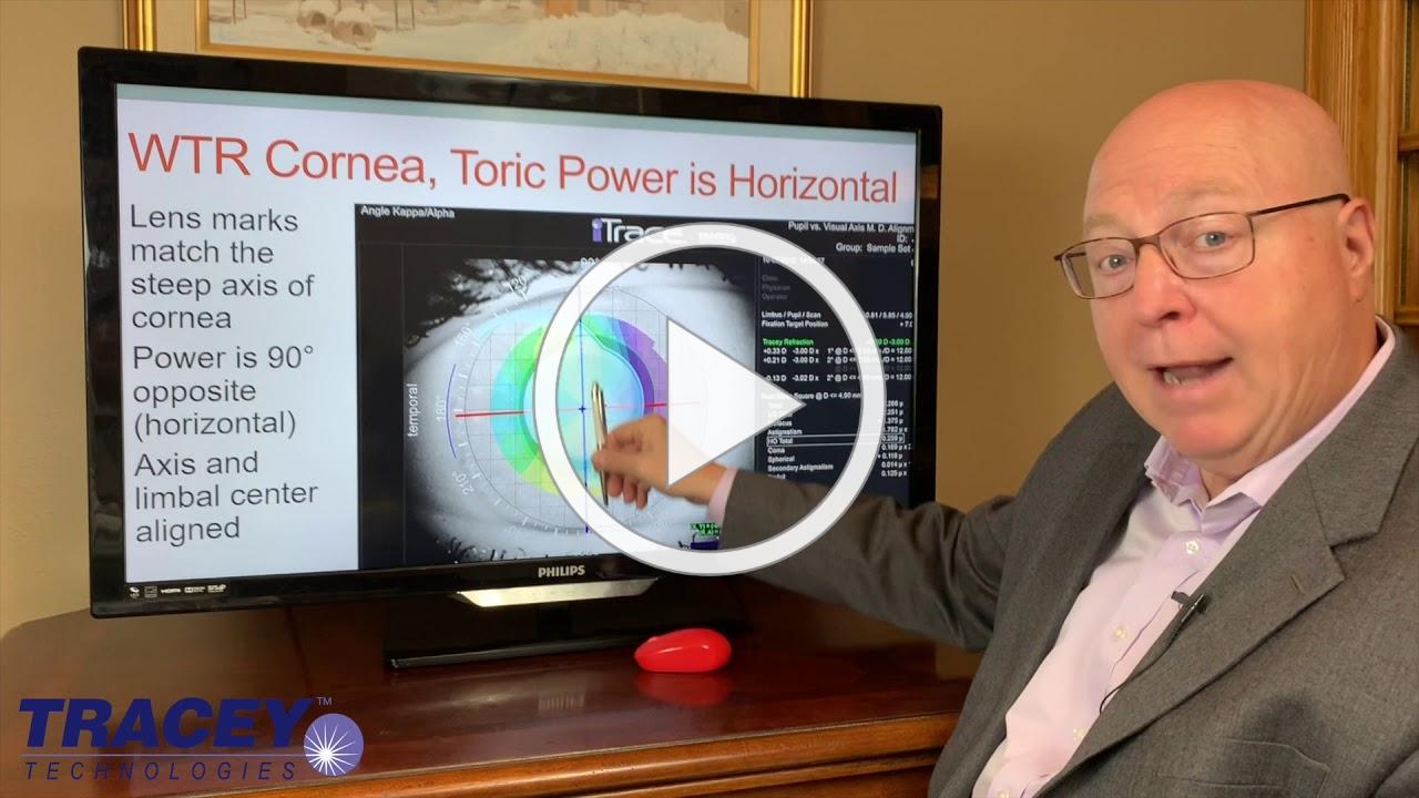 Video discussion about the iTrace can help to screen your Toric Lens