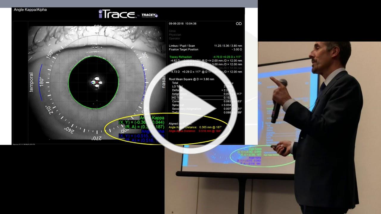 Video discussion of understanding the value of using iTrace