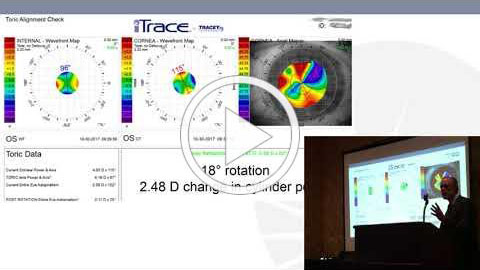 Video presentation with Francis Price, M.D