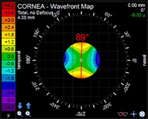 Cornea wavefront map on toric check
