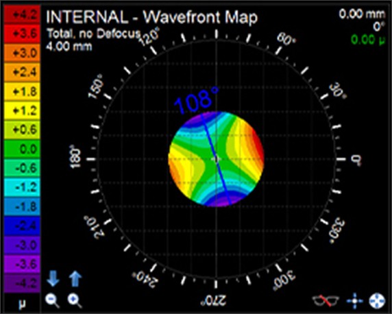 The internal wavefront map on the Toric alignment check