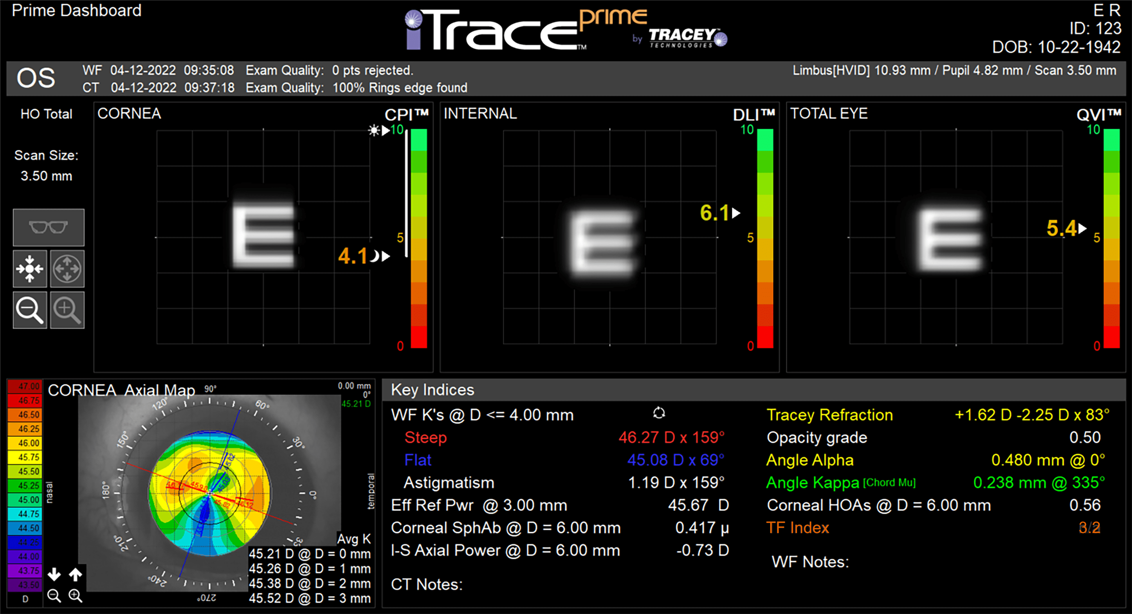 PrimeDbd_pt ER_OS iTrace Dysfunctional Lens Patient Display