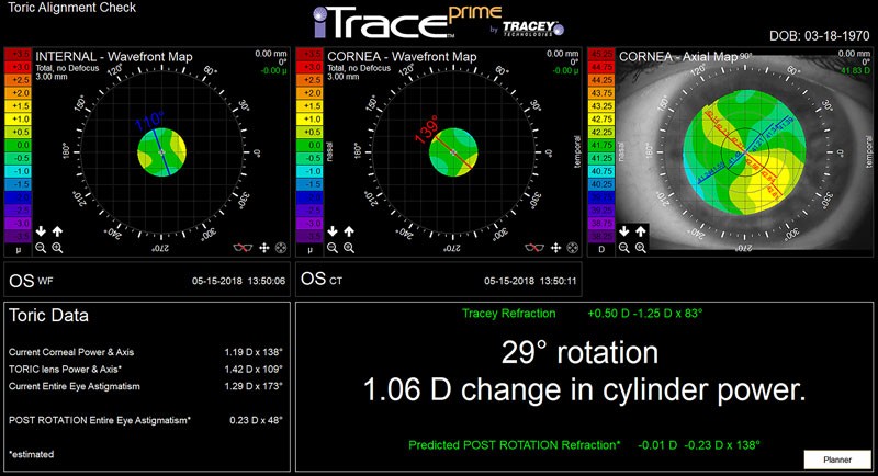 Toric Alignment Check at Tracey