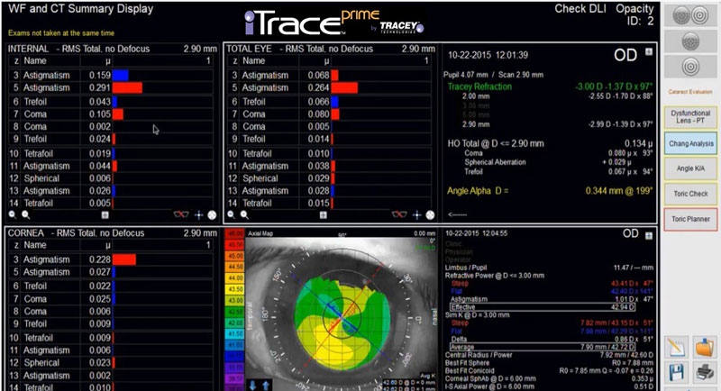 WF and CT Summary Display iTrace