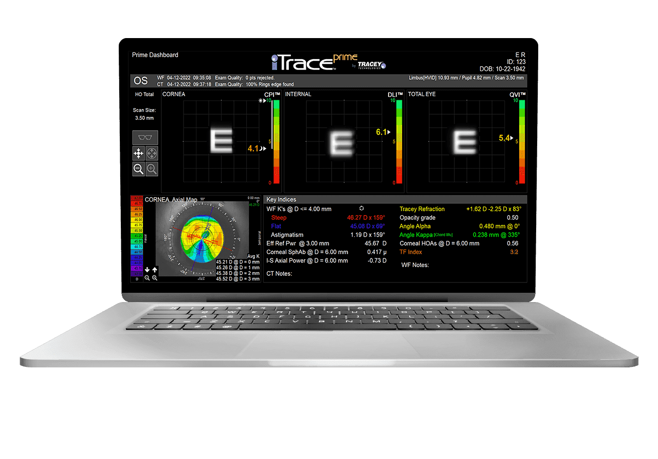 Laptop displaying Dysfunctional Lens Index