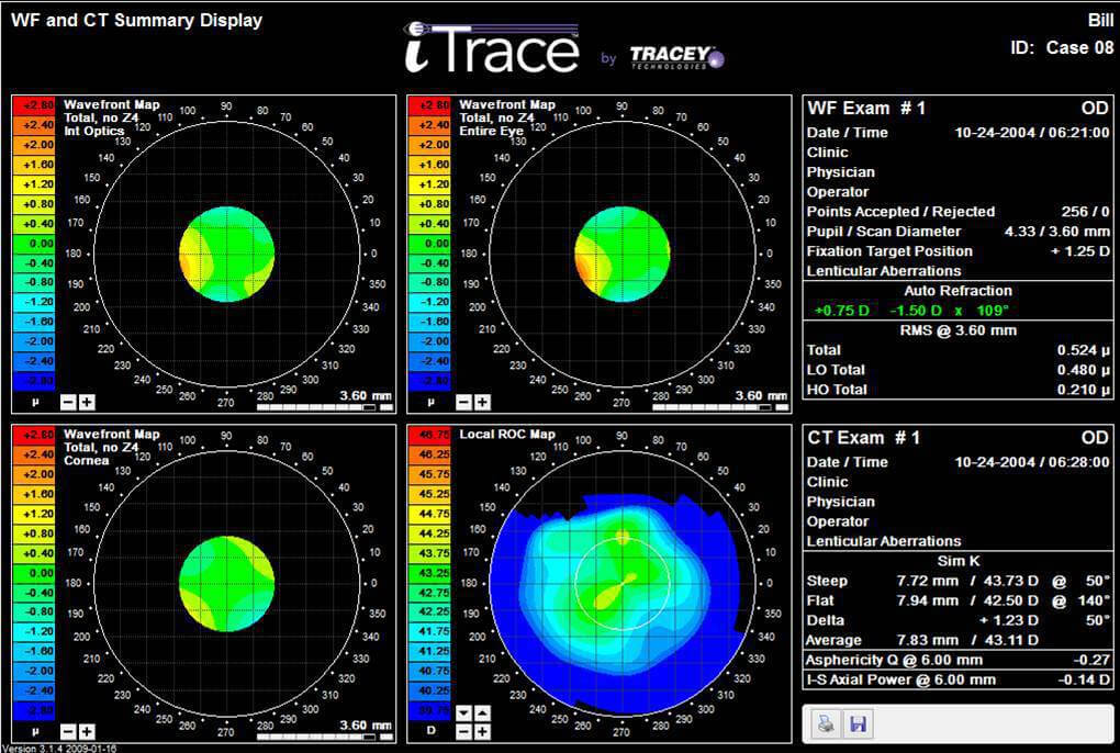 iTrace summary display in 2000