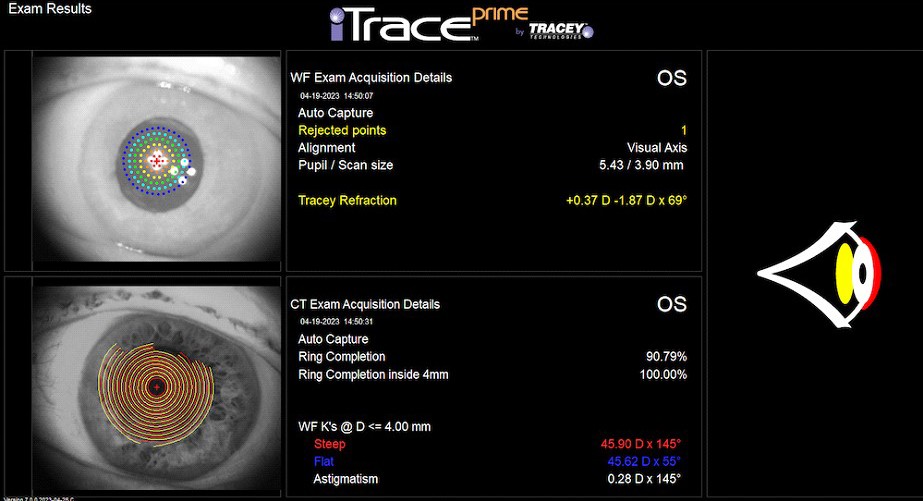 The iTrace Toric Check display