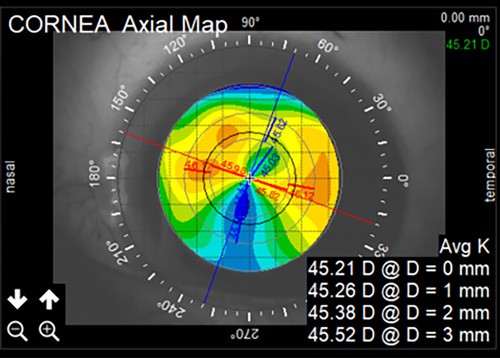 Total Eye Opacity Display