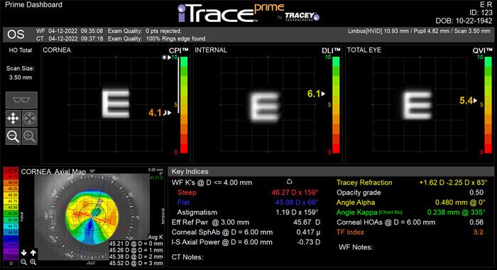 iTrace Dysfunctional Lens Patient Display