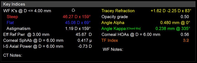 Tracey Refraction Display